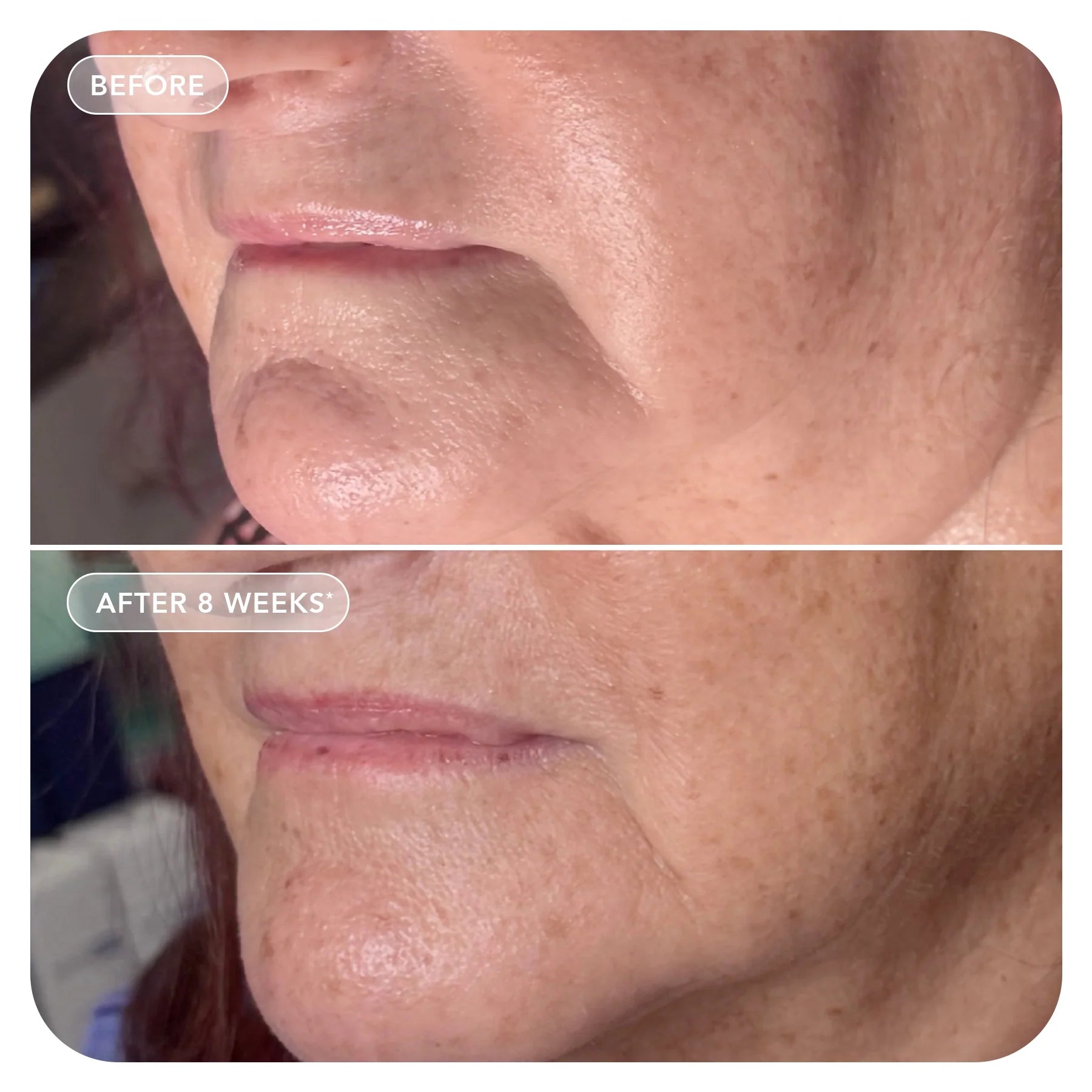 VOL.U.LIFT™ GLP-1 4D Skin Rebound Complex - Image Skincare Australia