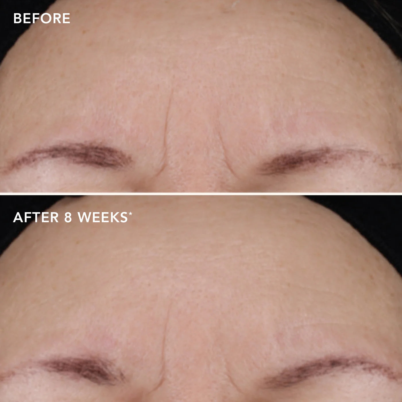 AGELESS+ retinol treatment crème 1.2% retinol complex - Image Skincare Australia