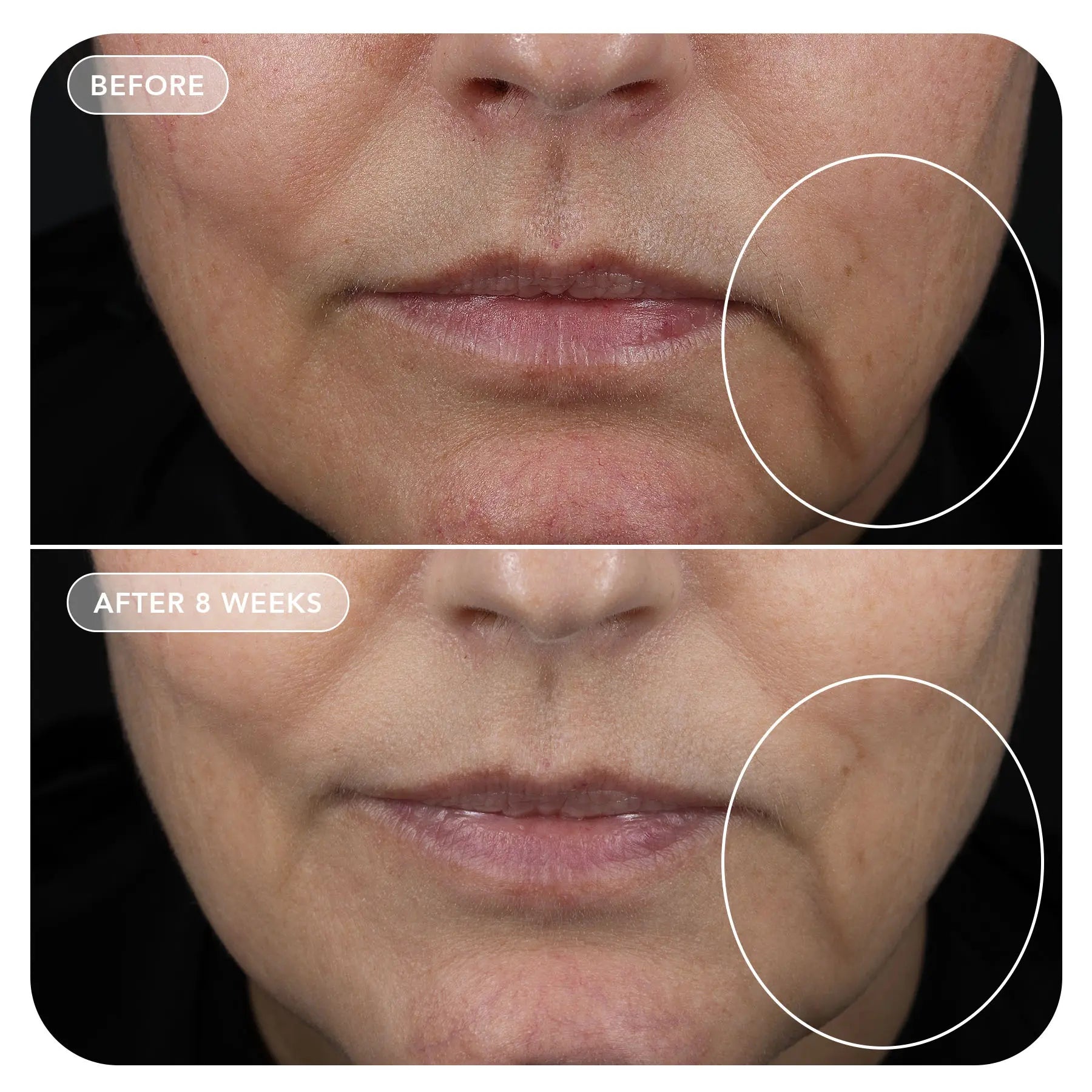 VOL.U.LIFT™ GLP-1 4D Skin Rebound Complex - Image Skincare Australia