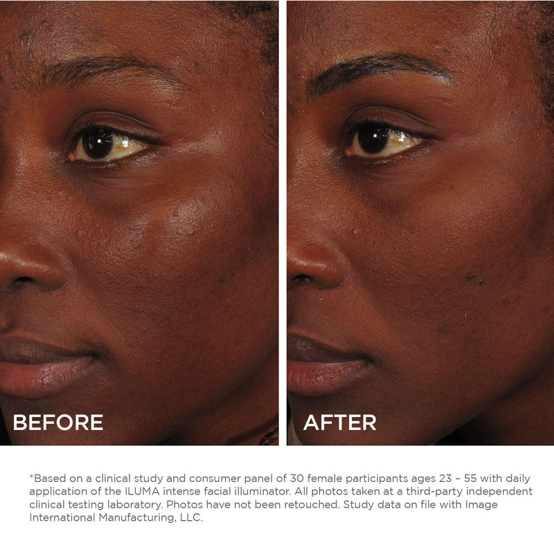 ILUMA intense facial illuminator - Image Skincare Australia