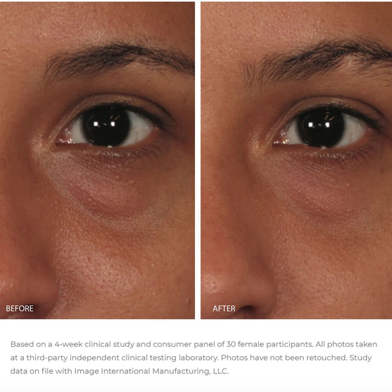 ORMEDIC balancing eye lift gel - Image Skincare Australia