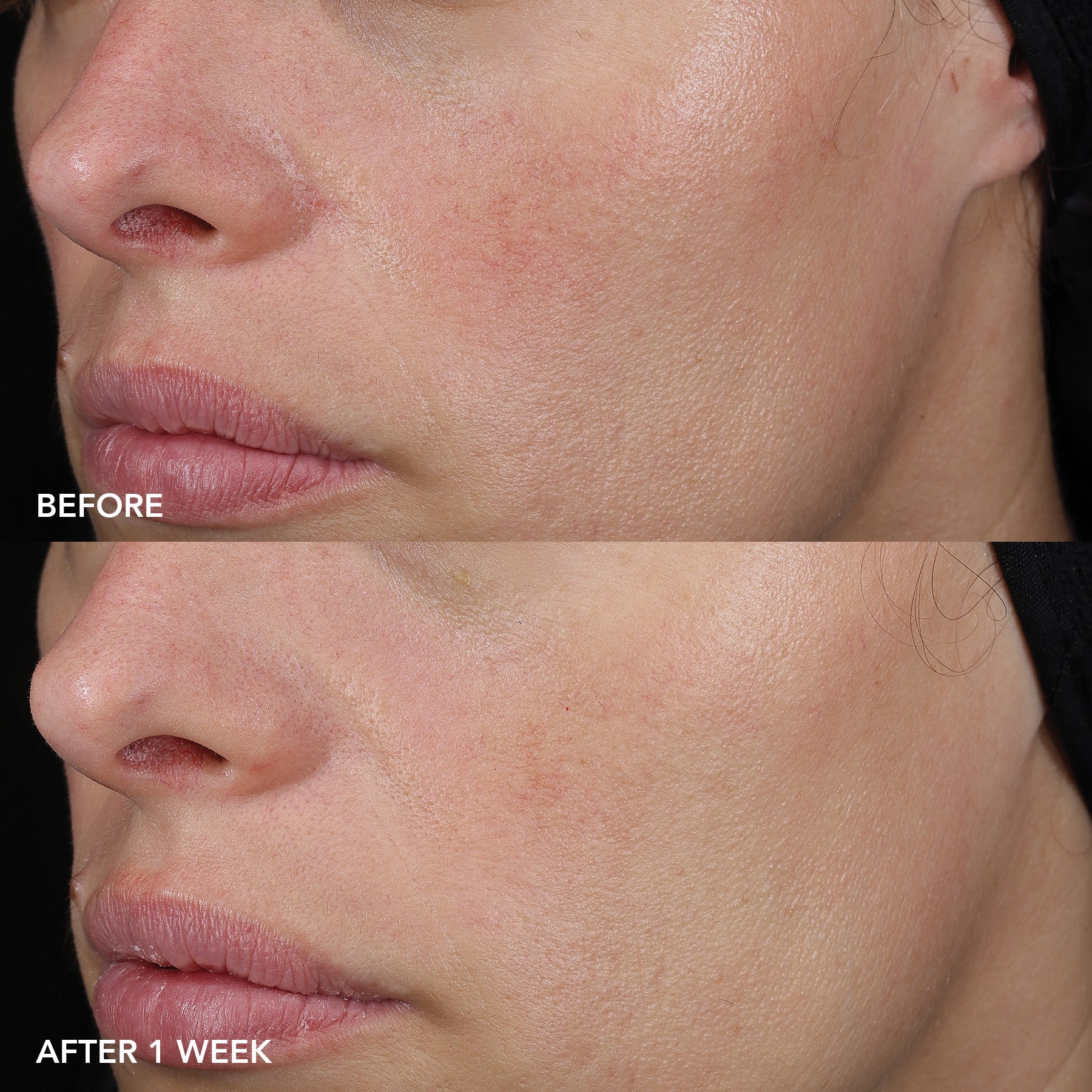 IMAGE MD Barrier Repair Recovery Balm (PRESCRIPTION ONLY) - Image Skincare Australia