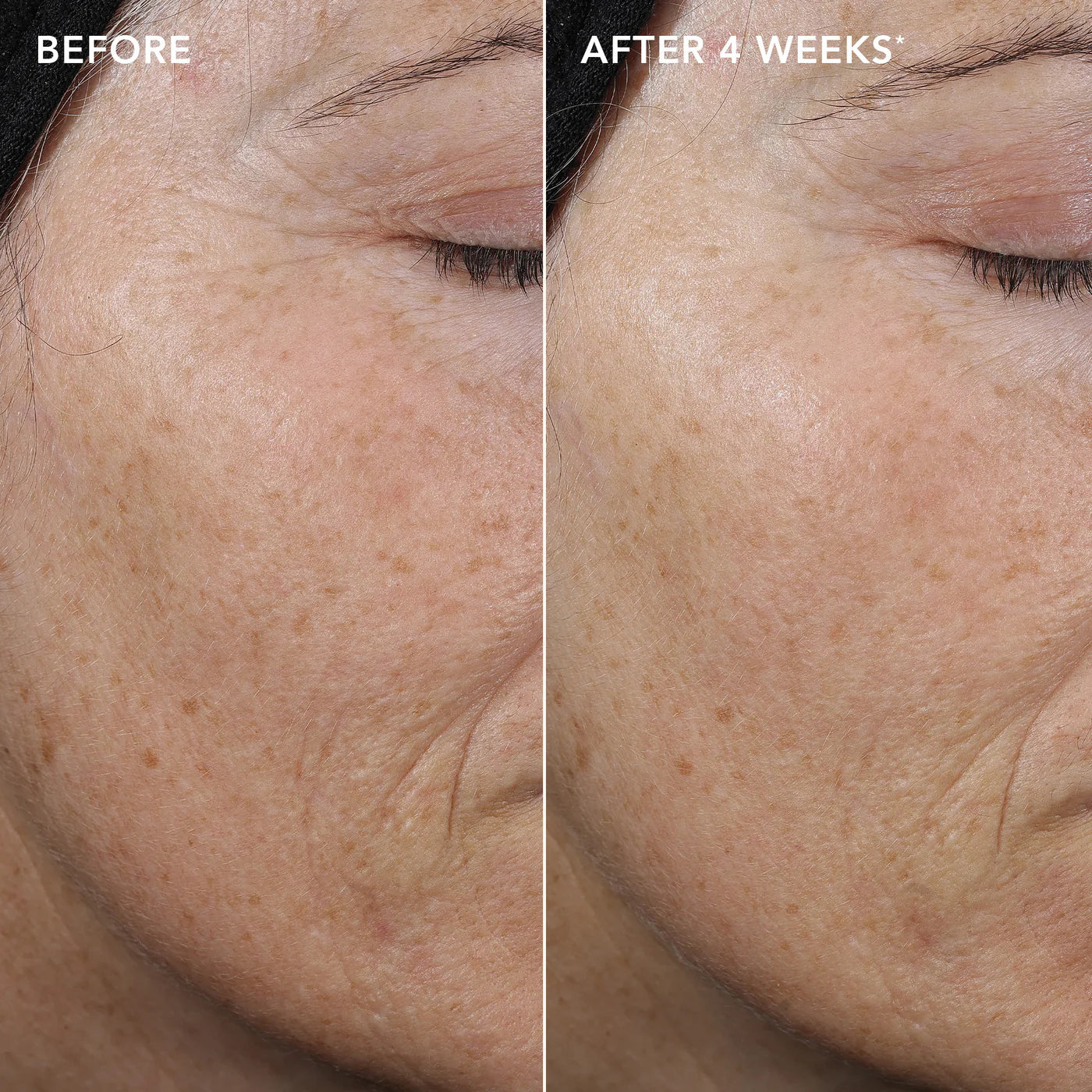 AGELESS+ retinol pure liquid retinol 0.3% - Image Skincare Australia