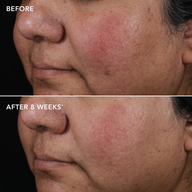 AGELESS+ retinol pure liquid retinol 0.75% - Image Skincare Australia