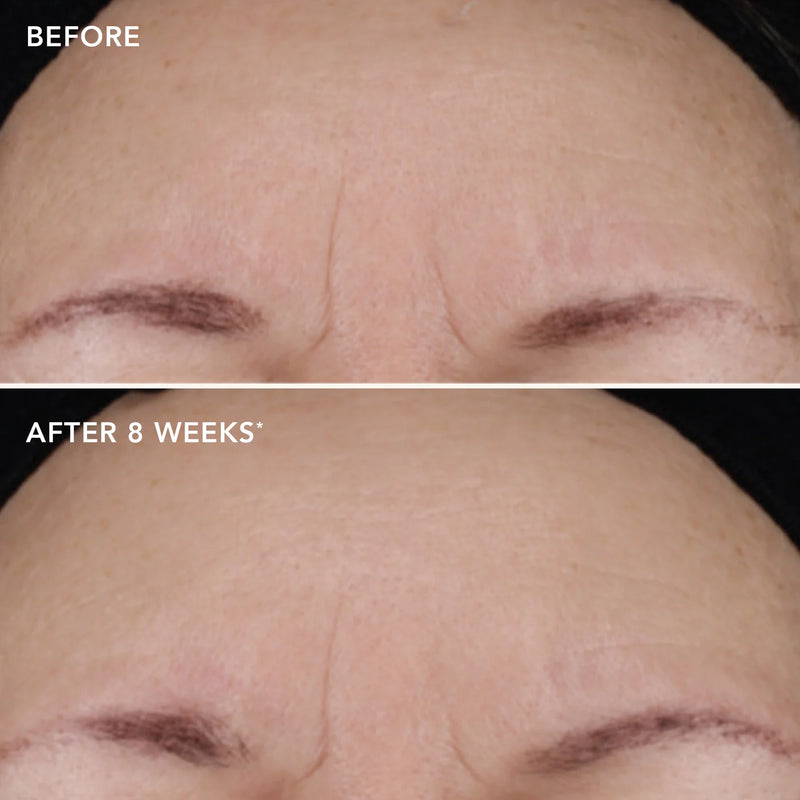 AGELESS+ retinol treatment crème 1.2% retinol complex - Image Skincare Australia