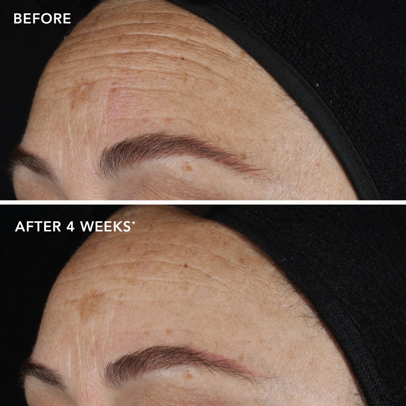 AGELESS+ retinol pure liquid retinol 0.1% - Image Skincare Australia