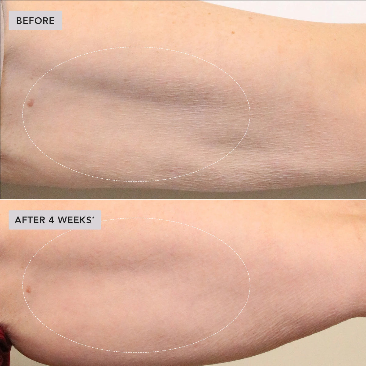 VOL.U.LIFT™ Body - Image Skincare Australia