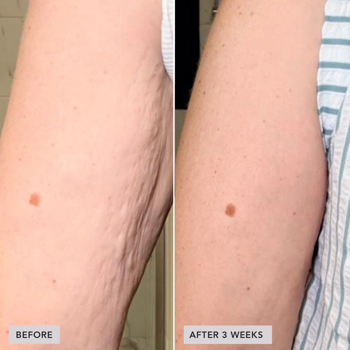 VOL.U.LIFT™ Body - Image Skincare Australia