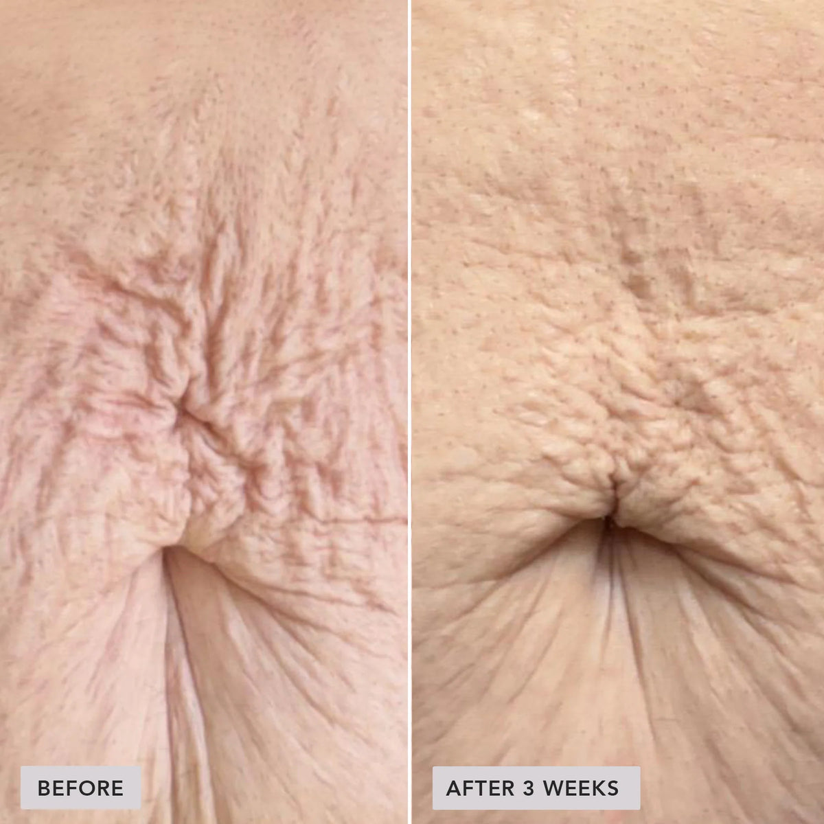 VOL.U.LIFT™ Body - Image Skincare Australia