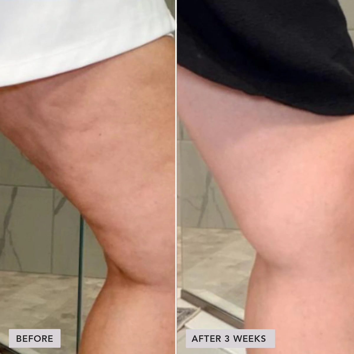 VOL.U.LIFT™ Body - Image Skincare Australia