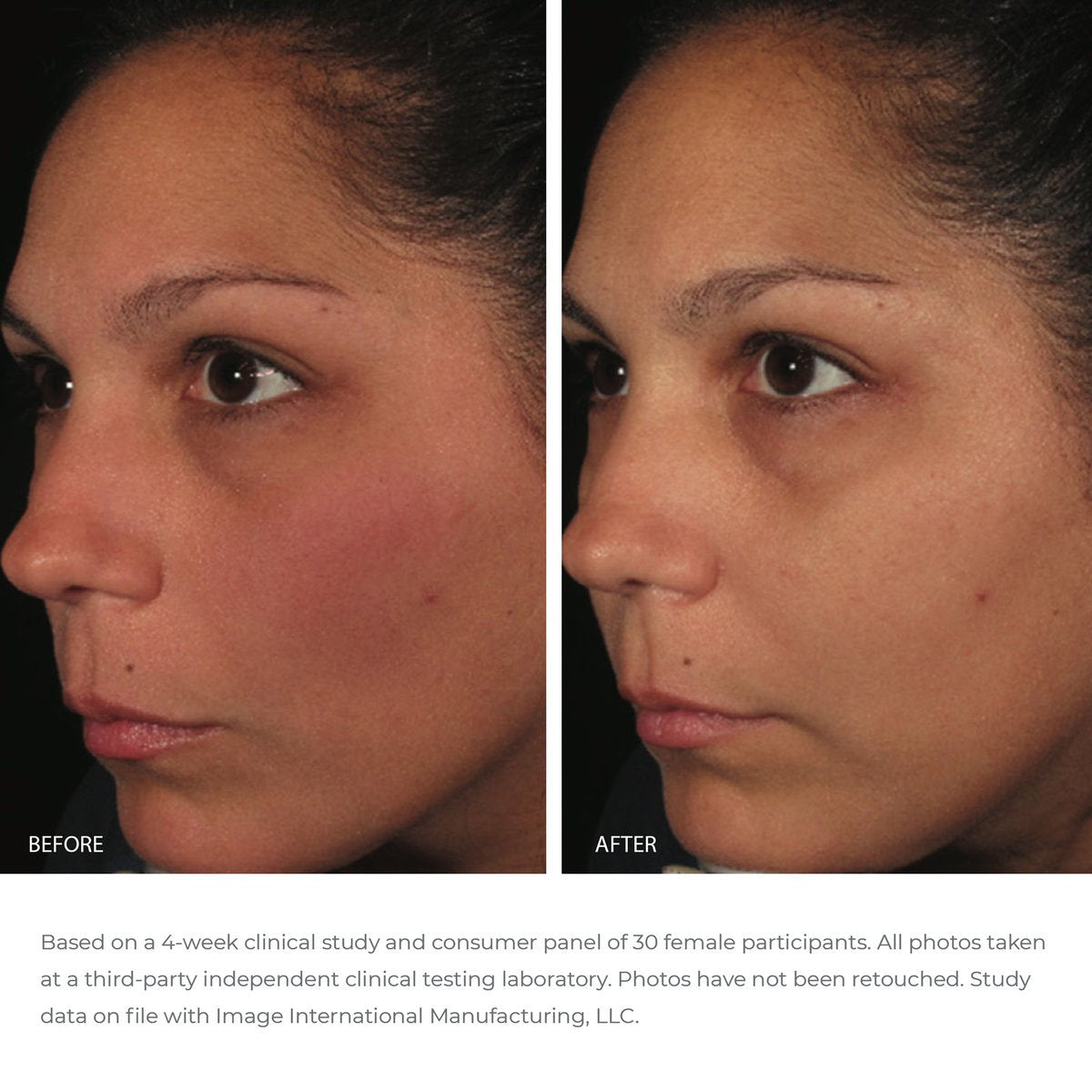 ORMEDIC balancing antioxidant serum - Image Skincare Australia