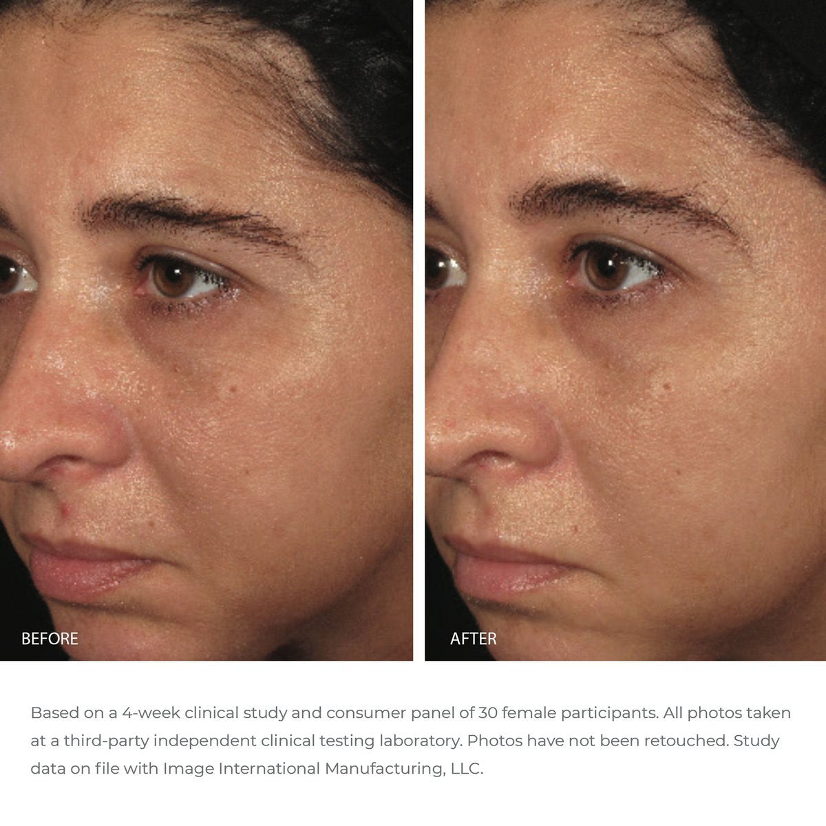 ORMEDIC balancing biopeptide crème - Image Skincare Australia